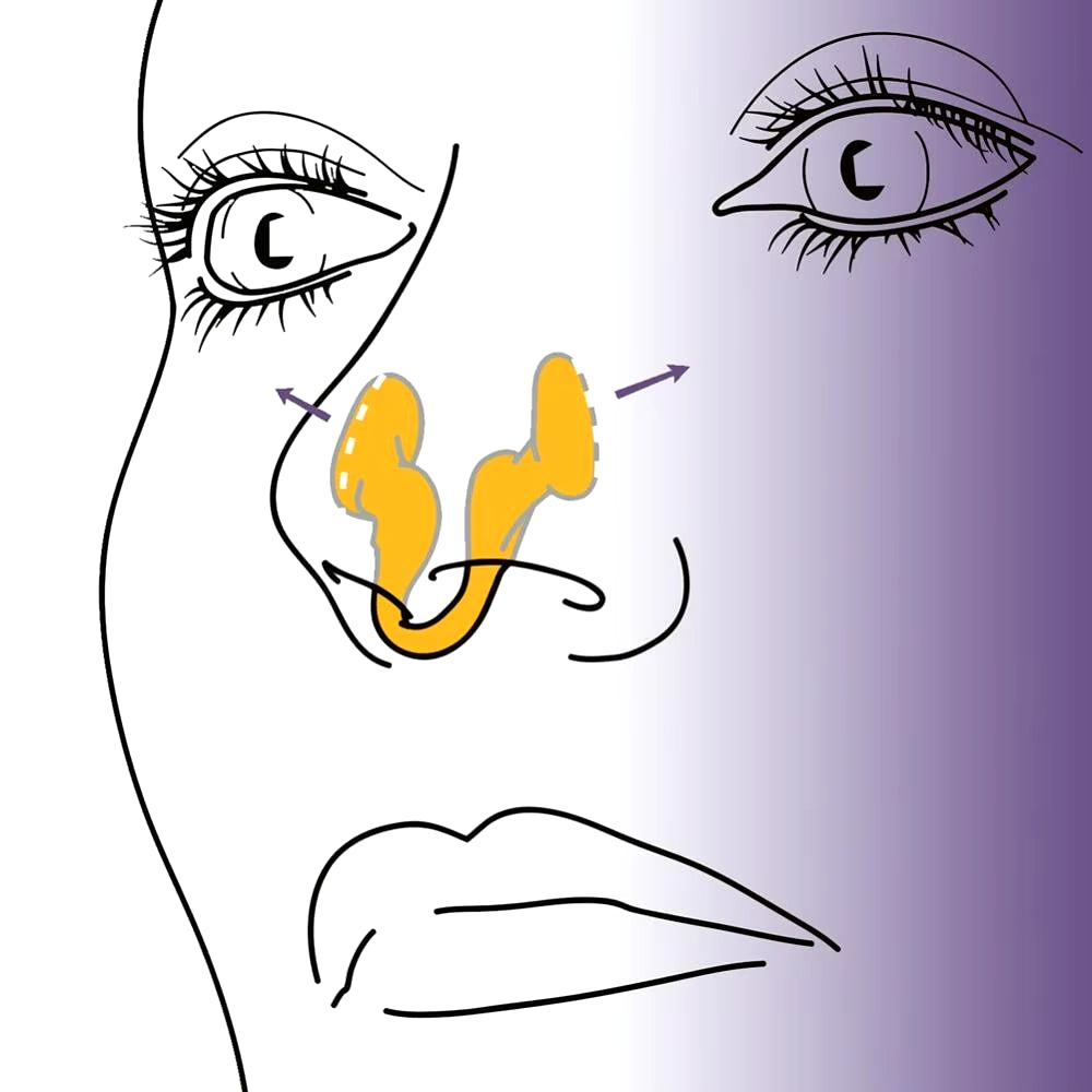 1 pince-nez en silicone anti-ronflement, dilatateur nasal, aide à arrêter le ronflement, facilite la respiration, améliore le sommeil et la rhinite