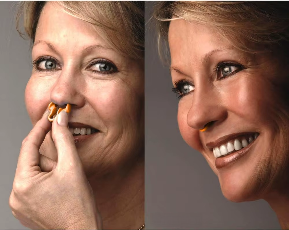 Dilatateur Nasal Confort+ – Simplicité & discrétion au quotidien